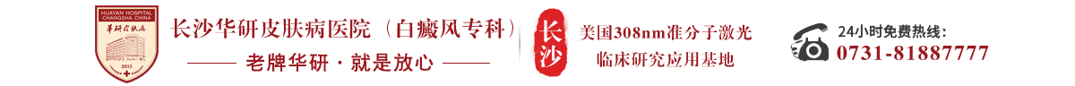 长沙白癜风医院