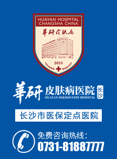 华研白癜风